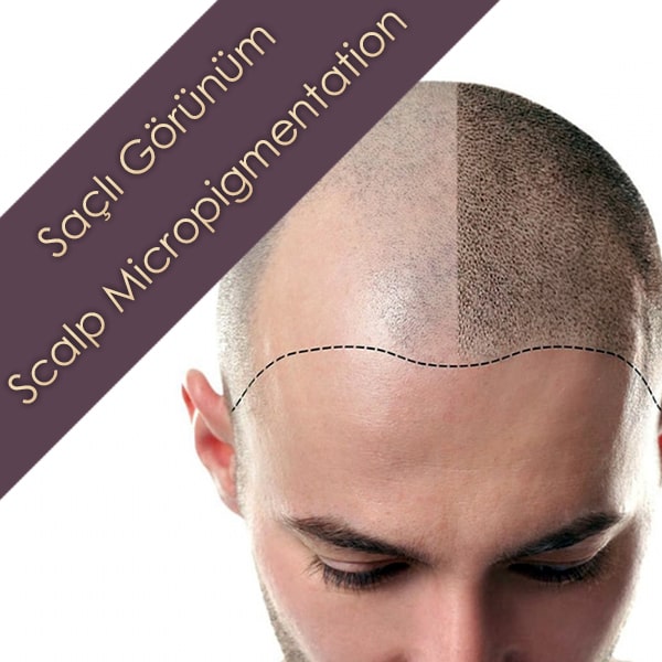 Saç Simülasyon Kursu | Saçlı Görünüm, SMP, Scalp Micropigmentation | Isparta Eğitimleri